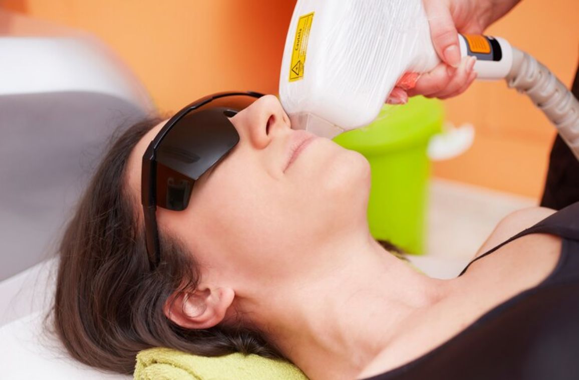 Does laser hair removal really provide permanent results?