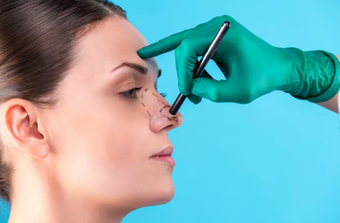 Is rhinoplasty right for you? Exploring Benefits and Risks