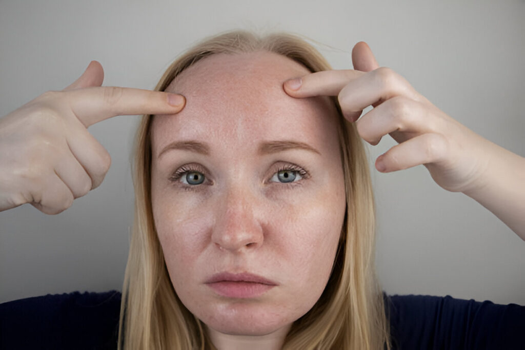 pigmentation treatment in Hyderabad